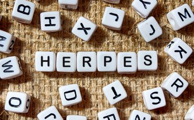 Herpes written in scrabble blocks image